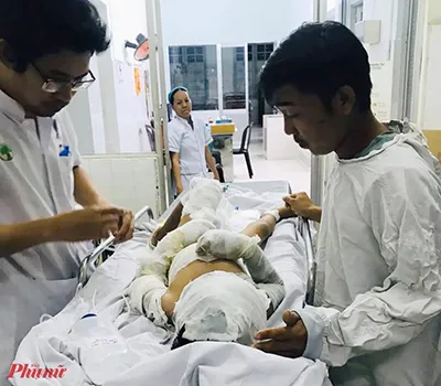 Bệnh nhi bị bỏng nặng do người lớn đổ xăng châm lửa đốt