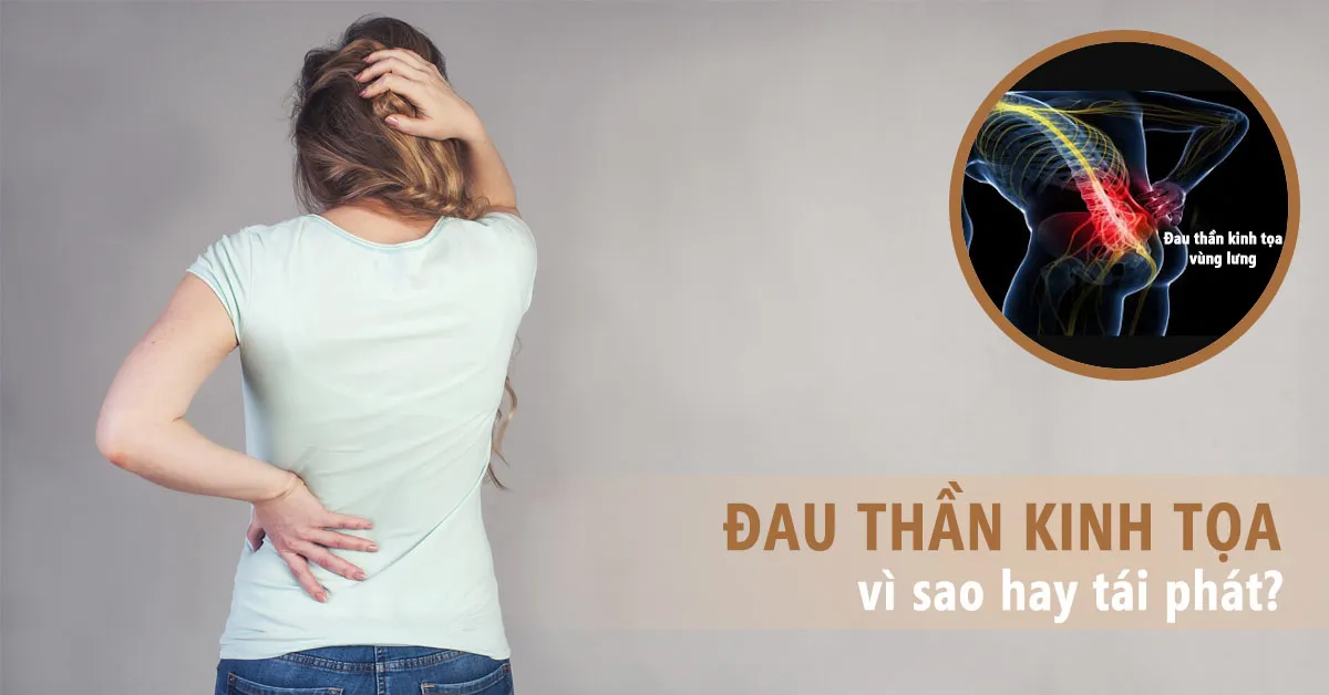 Đau thần kinh tọa vì sao hay tái phát?