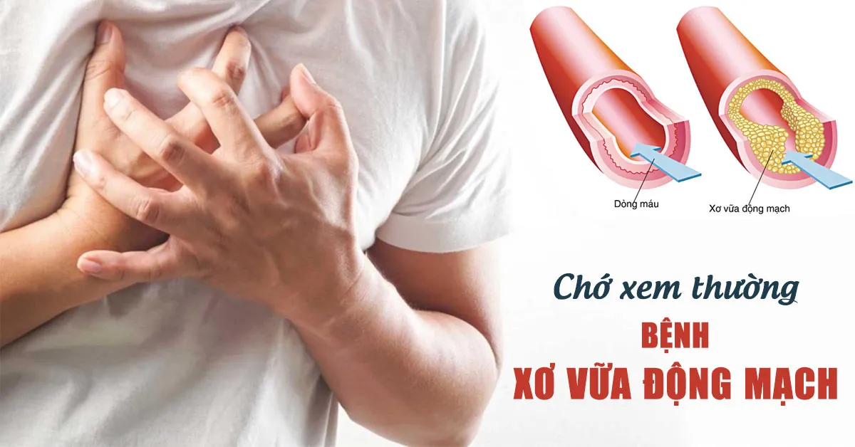 Xơ vữa động mạch máu và những hệ lụy sức khỏe không thể xem nhẹ