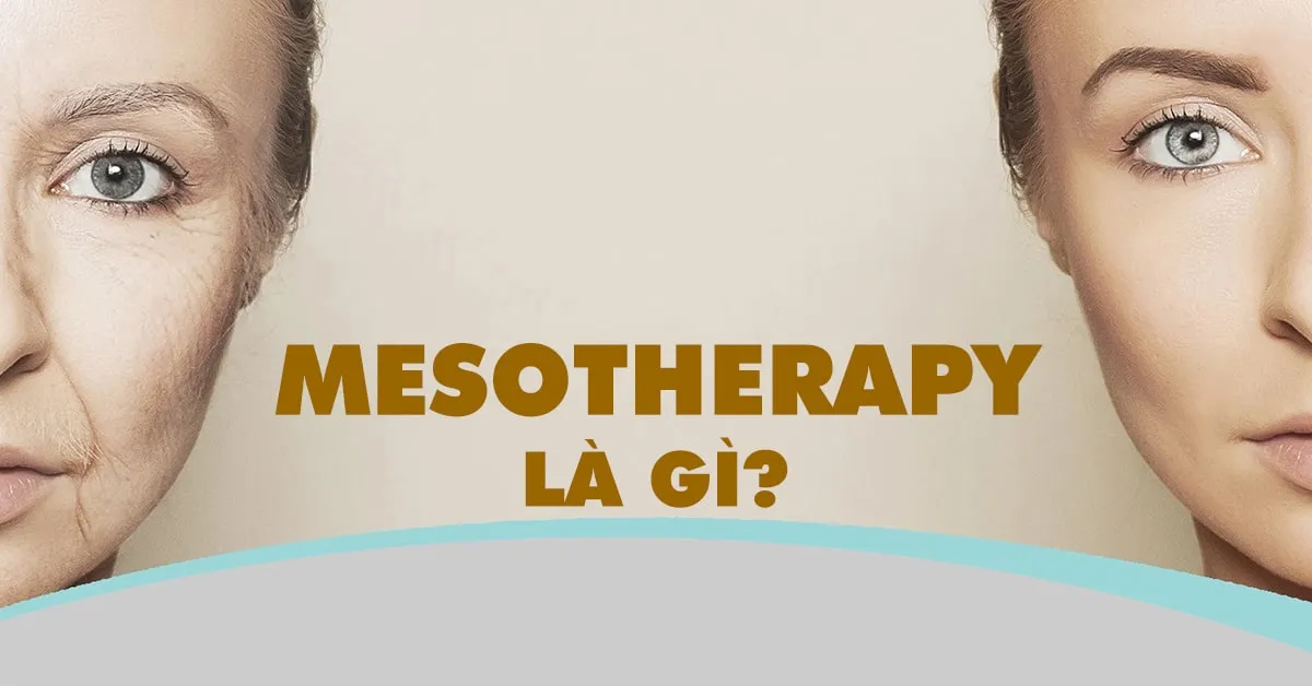 Mesotherapy là gì? Lợi ích làm đẹp của liệu pháp mesotherapy