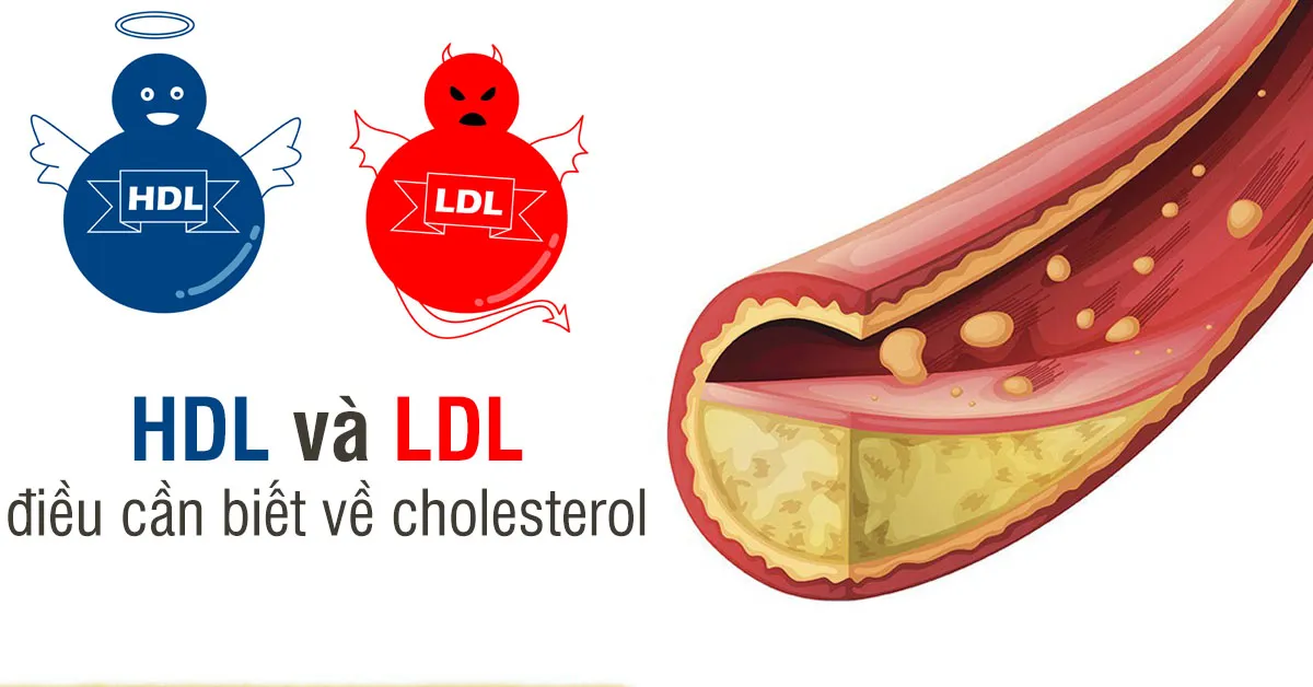 3 thời điểm cơ thể tự tổng hợp cholesterol xấu mà bạn không hay biết