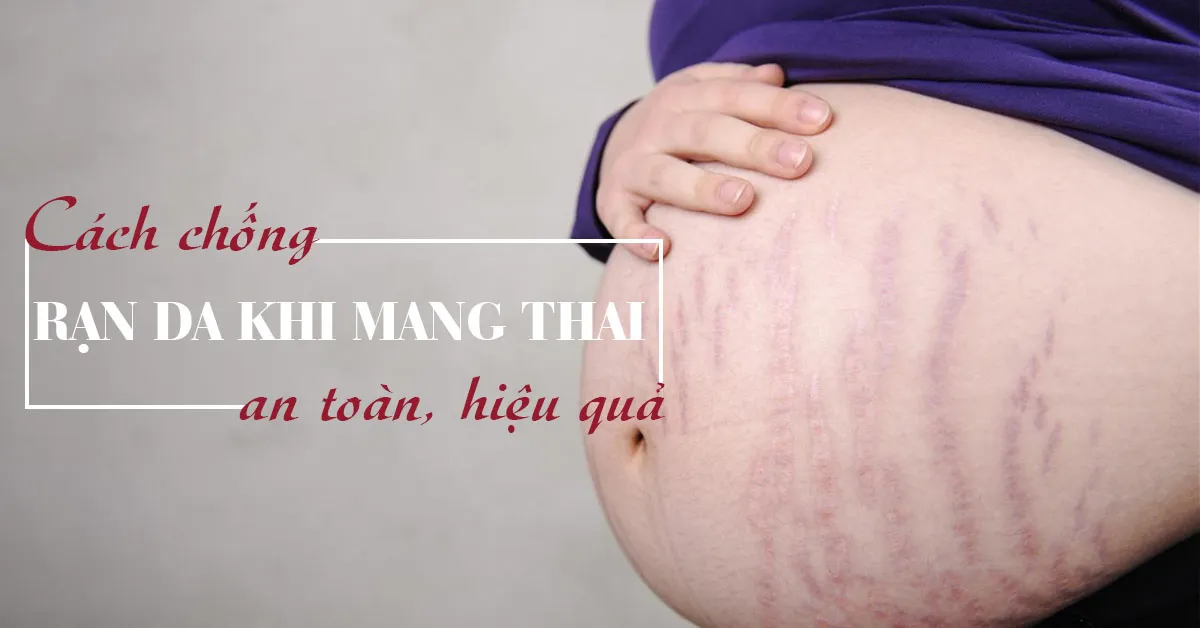 Rạn da khi mang thai: Nguyên nhân và biện pháp phòng ngừa