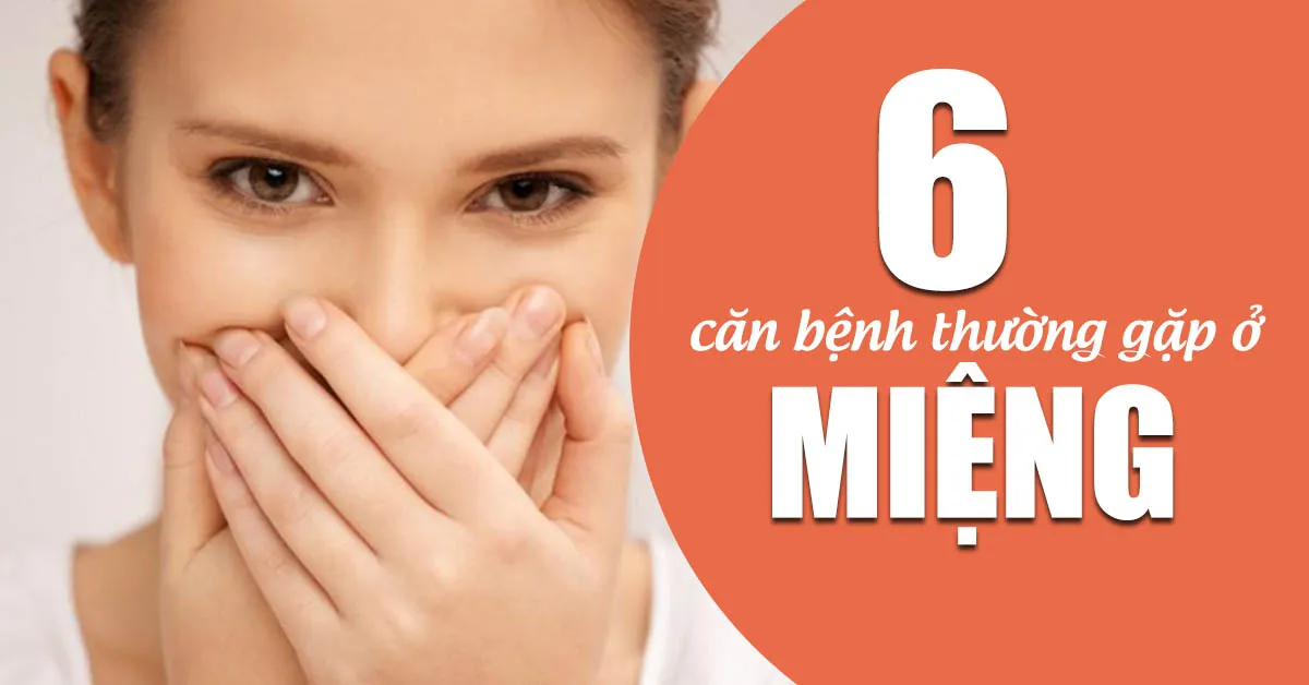 Những căn bệnh thường gặp ở miệng