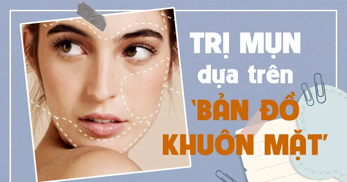 Giải mã nguyên nhân nổi mụn dựa trên ‘bản đồ khuôn mặt’