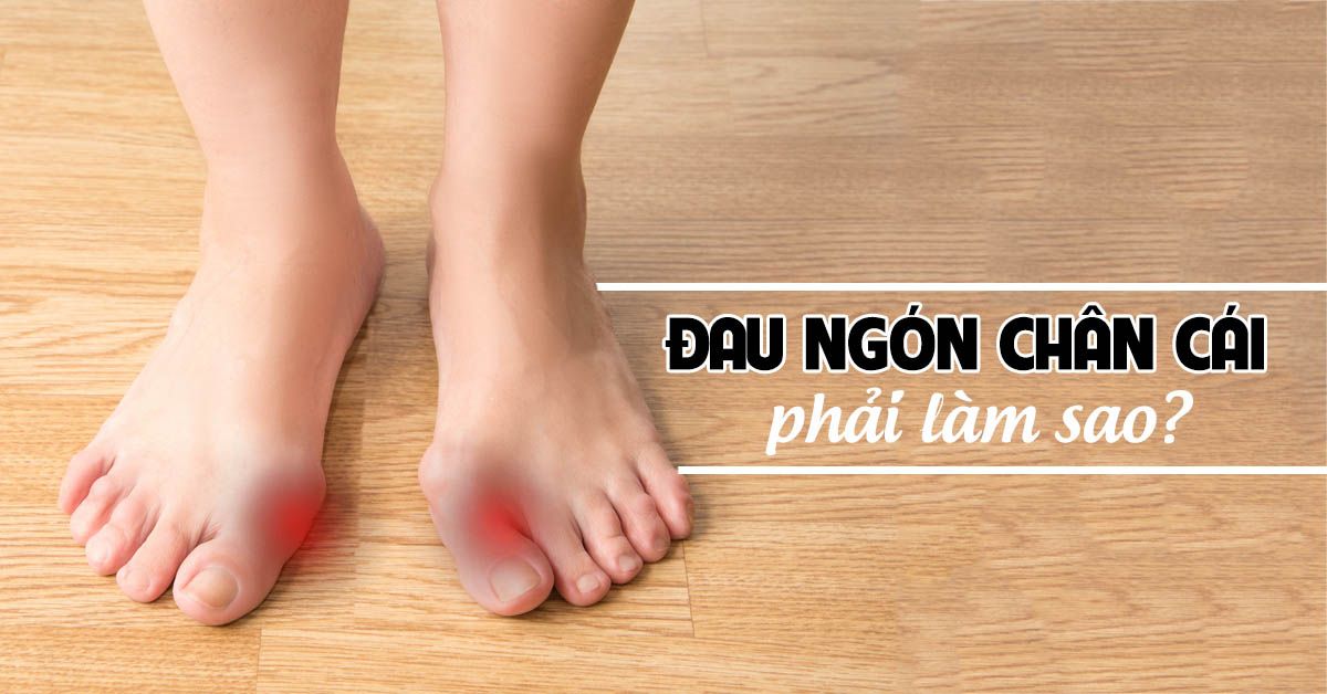 Đau ngón chân cái làm sao để hết đau?