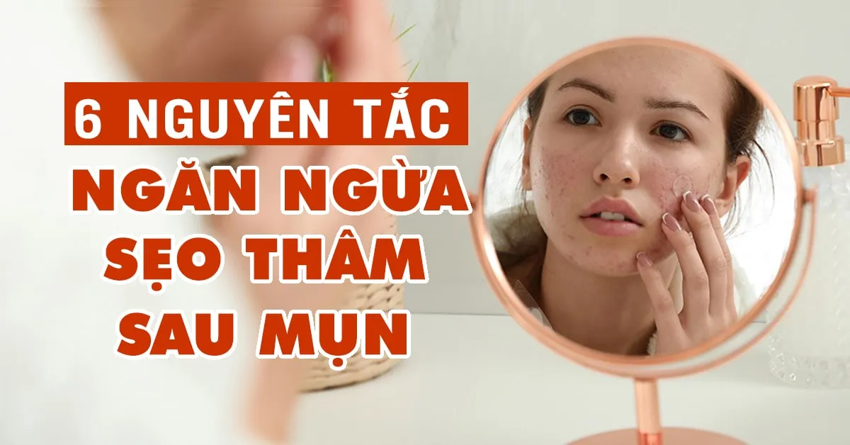 6 nguyên tắc cần nhớ để tránh sẹo thâm sau mụn