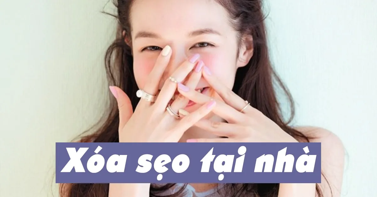 Xóa sẹo tại nhà ‘dễ ợt’ với 9 nguyên liệu từ thiên nhiên