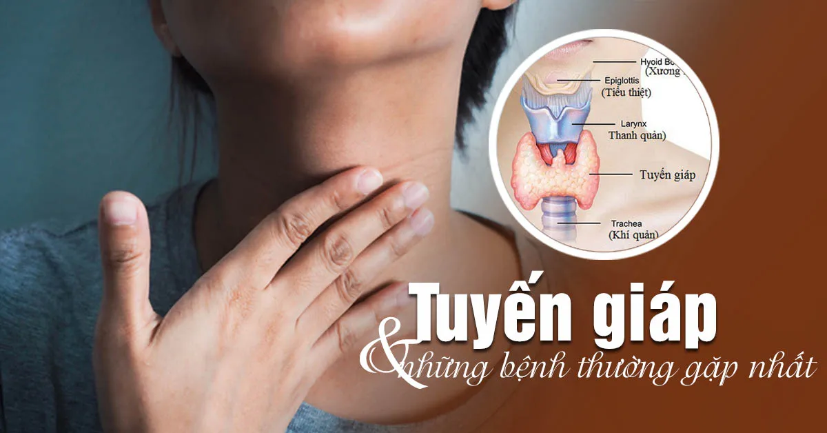 Tuyến giáp là gì, u tuyến giáp có nguy hiểm không?