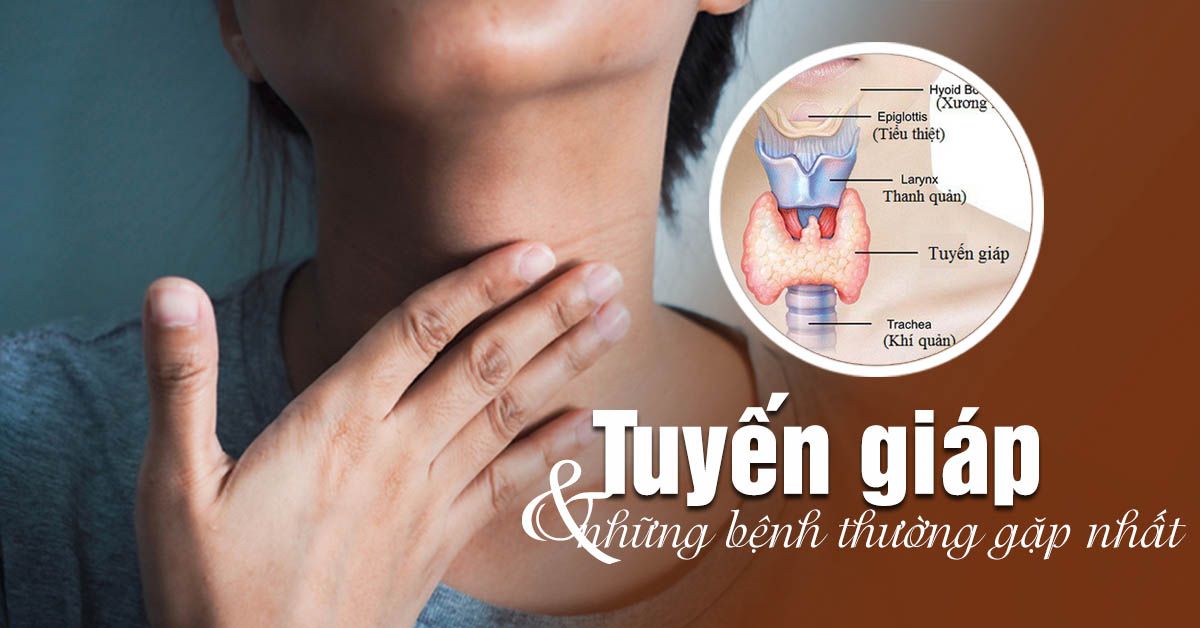 Tuyến giáp là gì, u tuyến giáp có nguy hiểm không?