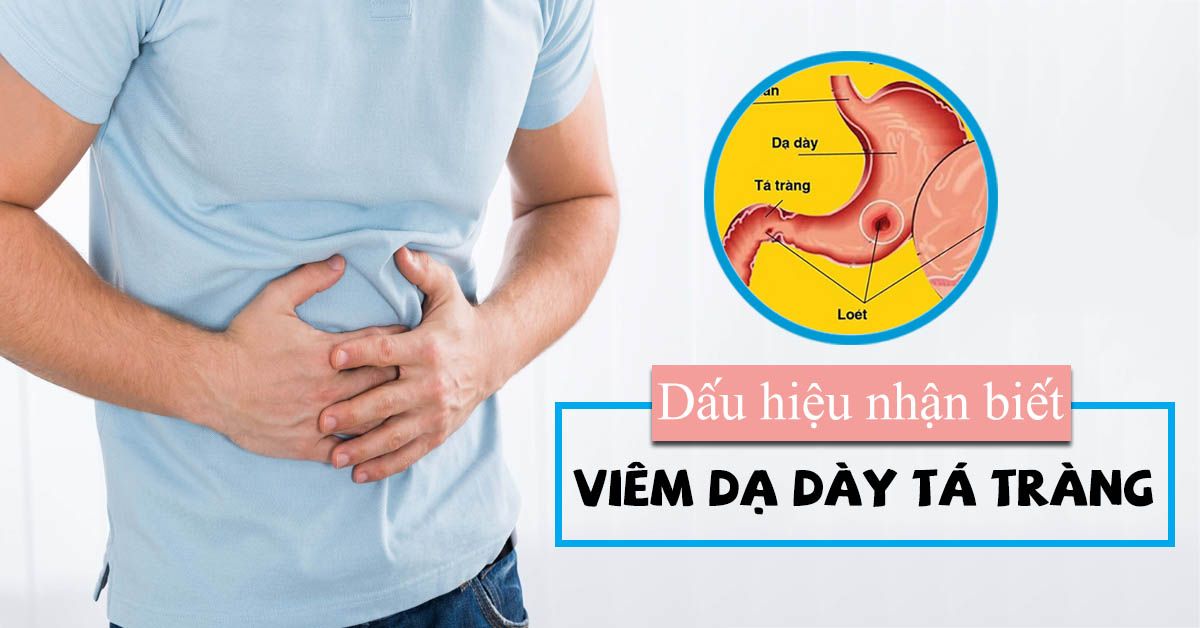 Viêm dạ dày tá tràng là gì? tìm hiểu nguyên nhân bệnh dễ tái phát