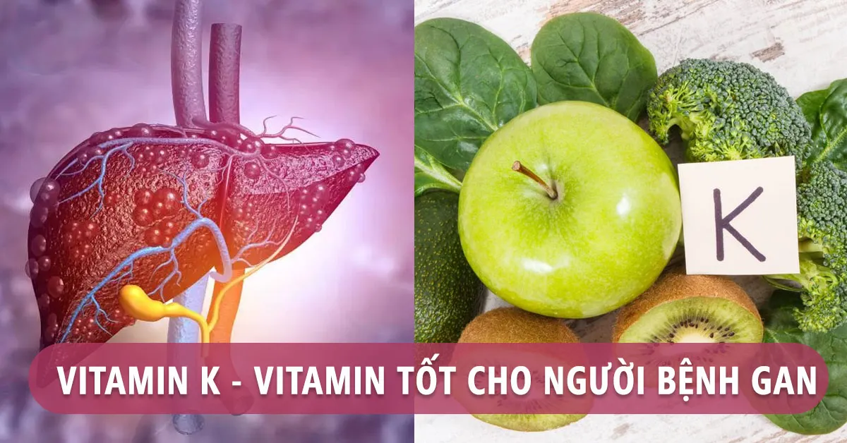 Vitamin K có tác dụng gì với người mắc bệnh gan?