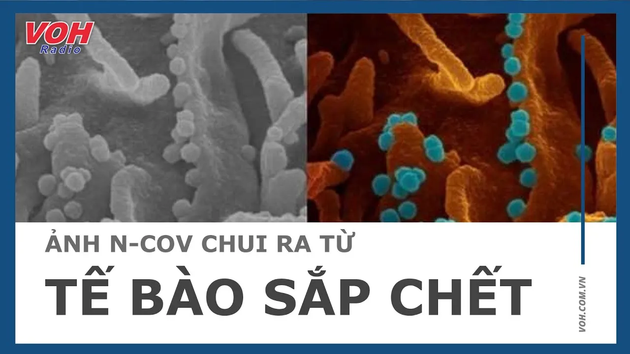 Ảnh nCoV chui ra từ tế bào sắp chết