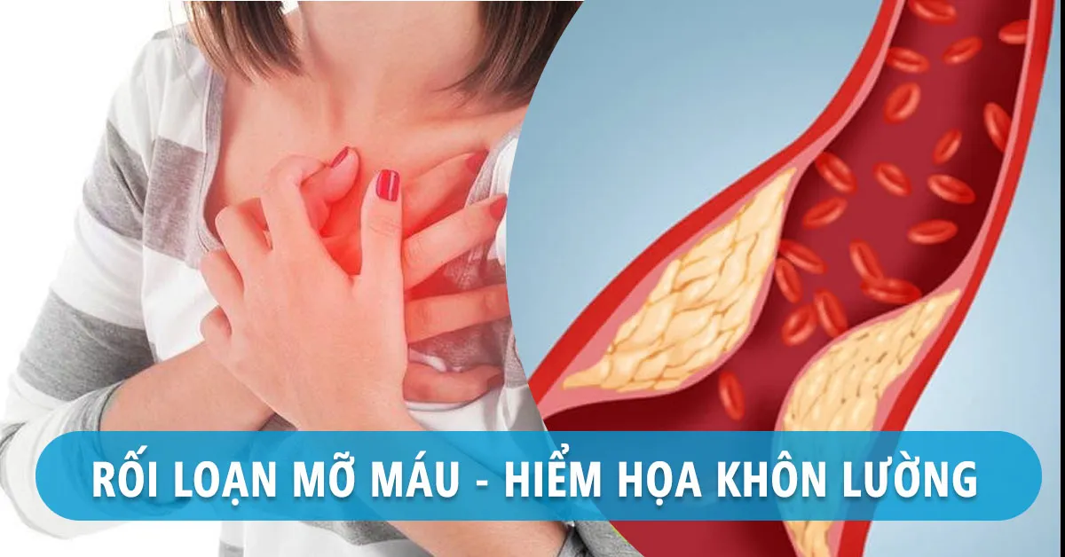 Rối loạn mỡ máu nguy hiểm thế nào, cách giúp bạn phòng ngừa hiệu quả