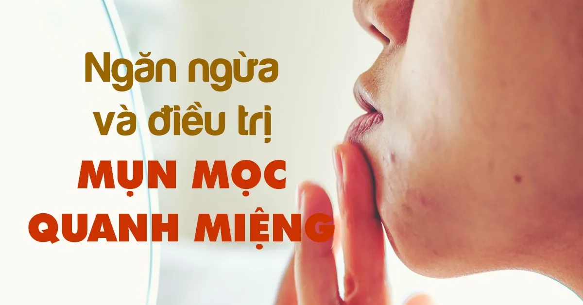 Mụn quanh miệng: nguyên nhân và 5 bước điều trị tận gốc