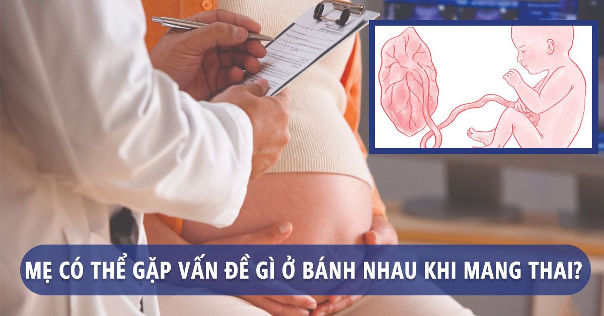 4 vấn đề của bánh nhau trong thai kỳ, có thể mẹ chưa biết!