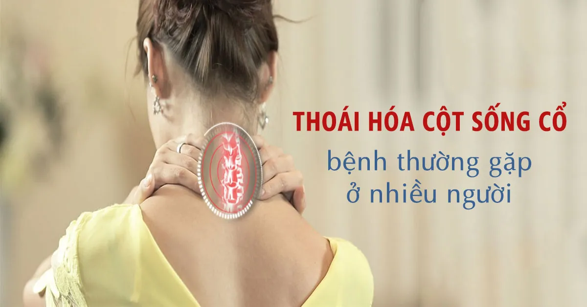 Nhận diện nhanh các dấu hiệu thoái hóa cột sống cổ