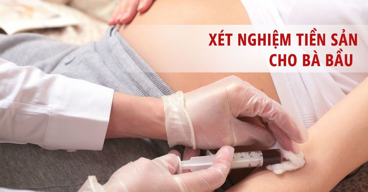 Tầm quan trọng của xét nghiệm tiền sản và các mốc thời gian cần nhớ