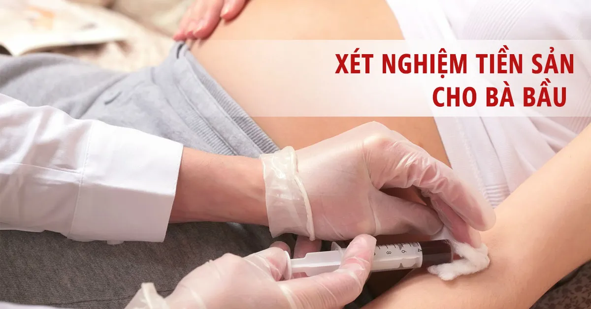 Tầm quan trọng của xét nghiệm tiền sản và các mốc thời gian cần nhớ