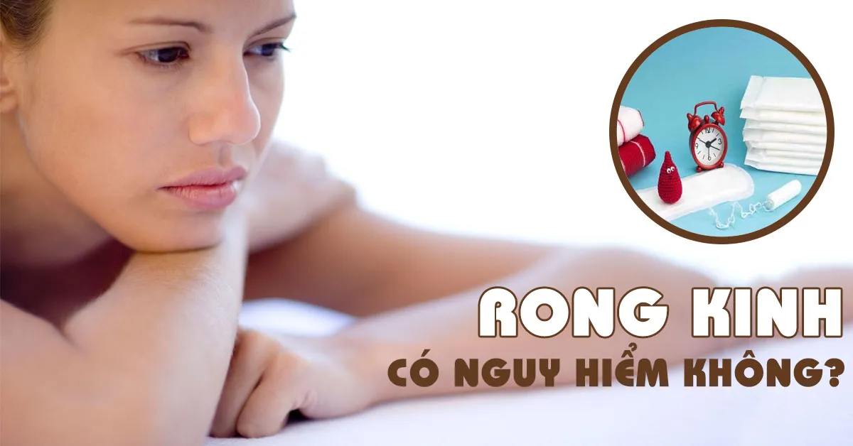 Rong kinh là gì? Có nguy hiểm không?