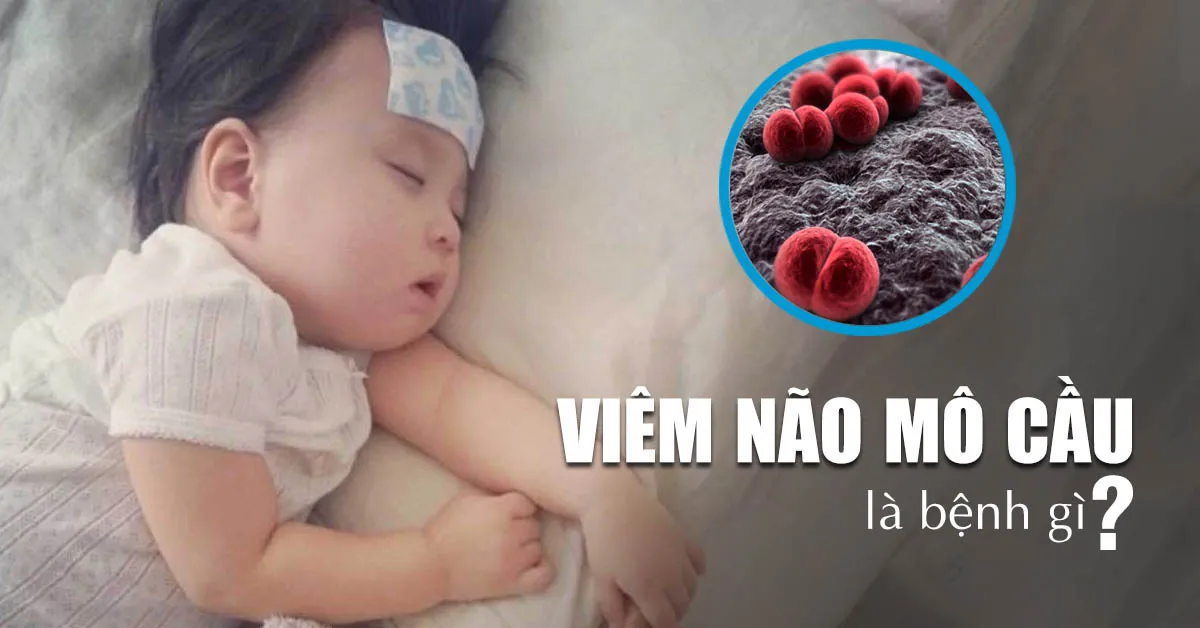 Viêm não mô cầu và những điều cần biết