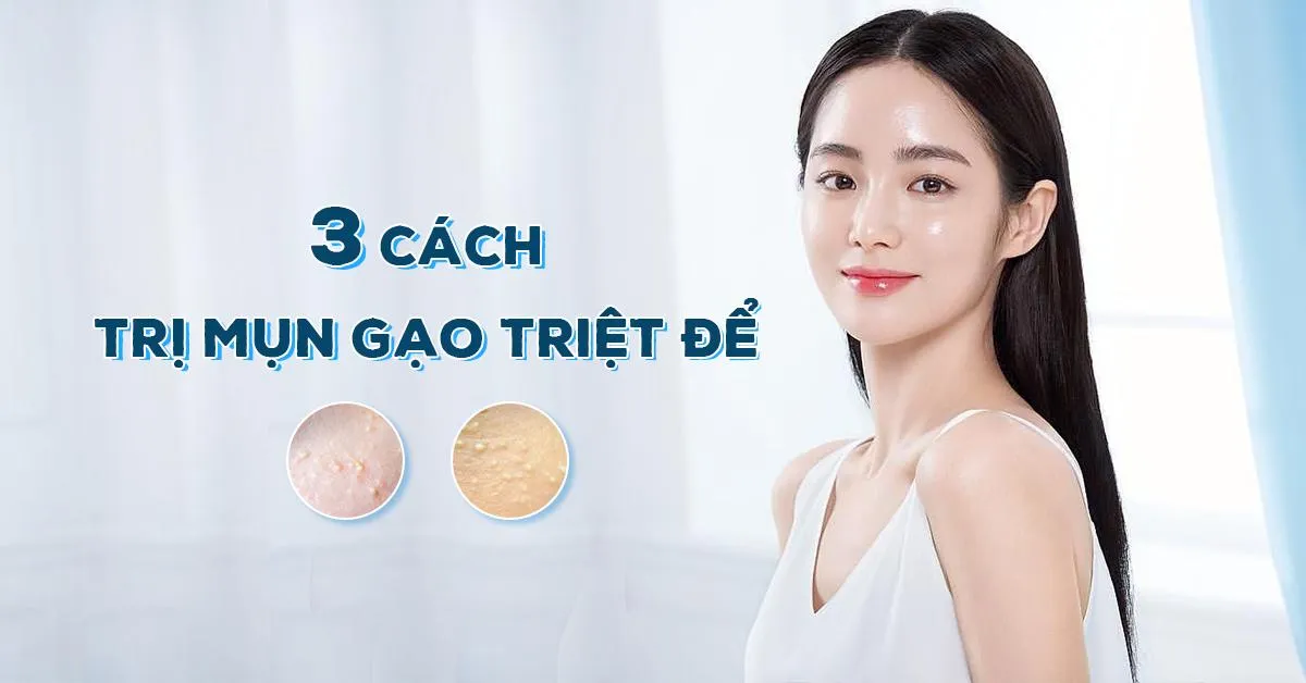 Bật mí 3 cách trị mụn gạo triệt để tại nhà