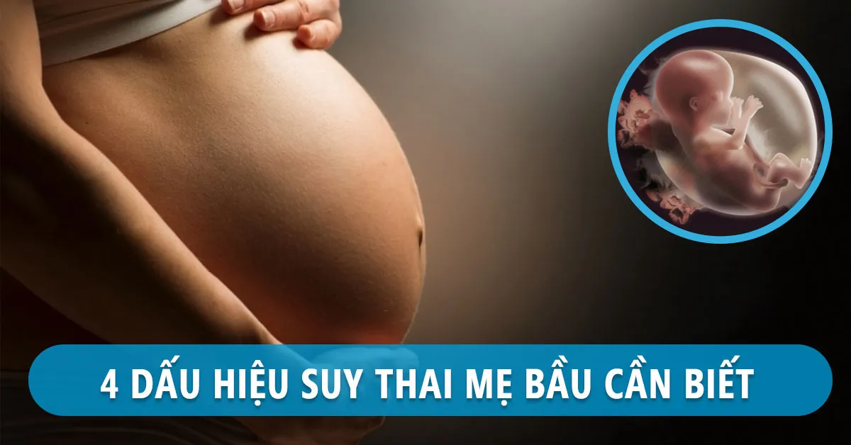 Suy thai: Nguyên nhân, triệu chứng và cách xử trí