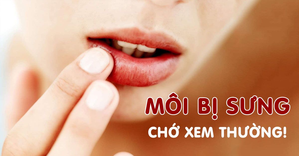 Môi bị sưng: Nguyên nhân và những cách xử trí đơn giản