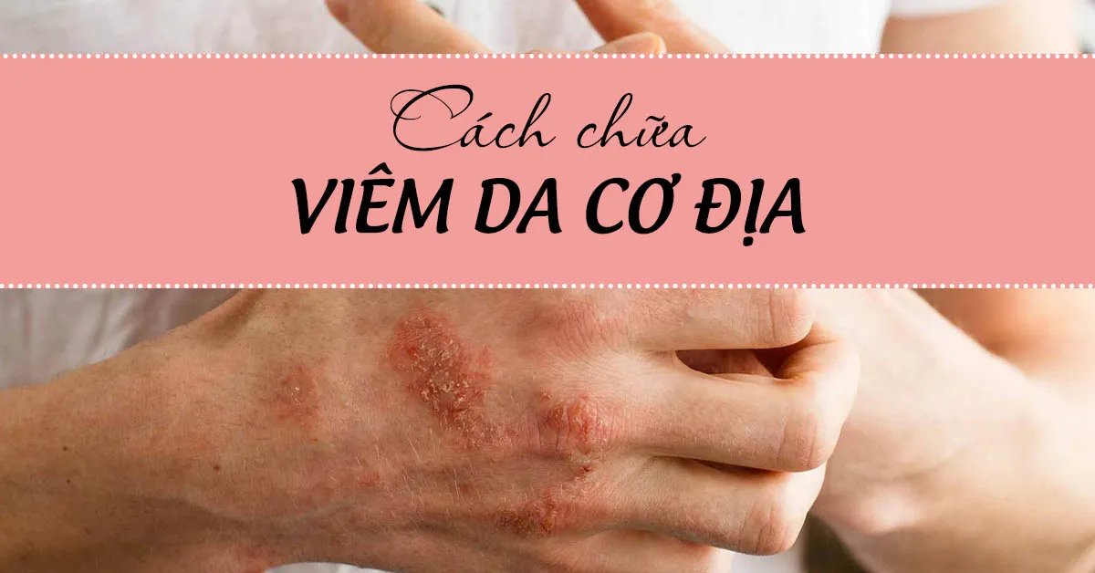 Tất tần tật 8 cách chữa viêm da cơ địa tại nhà