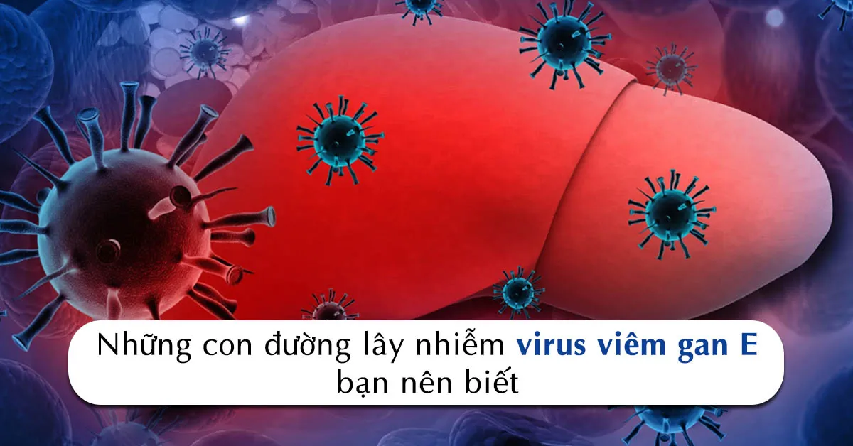 Viêm gan E có nguy hiểm như viêm gan A, B và C hay không?