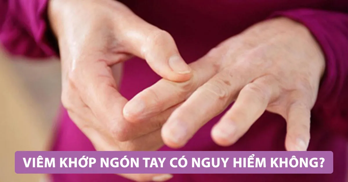 Viêm khớp ngón tay: Nguyên nhân, triệu chứng, chẩn đoán, cách điều trị và phòng ngừa