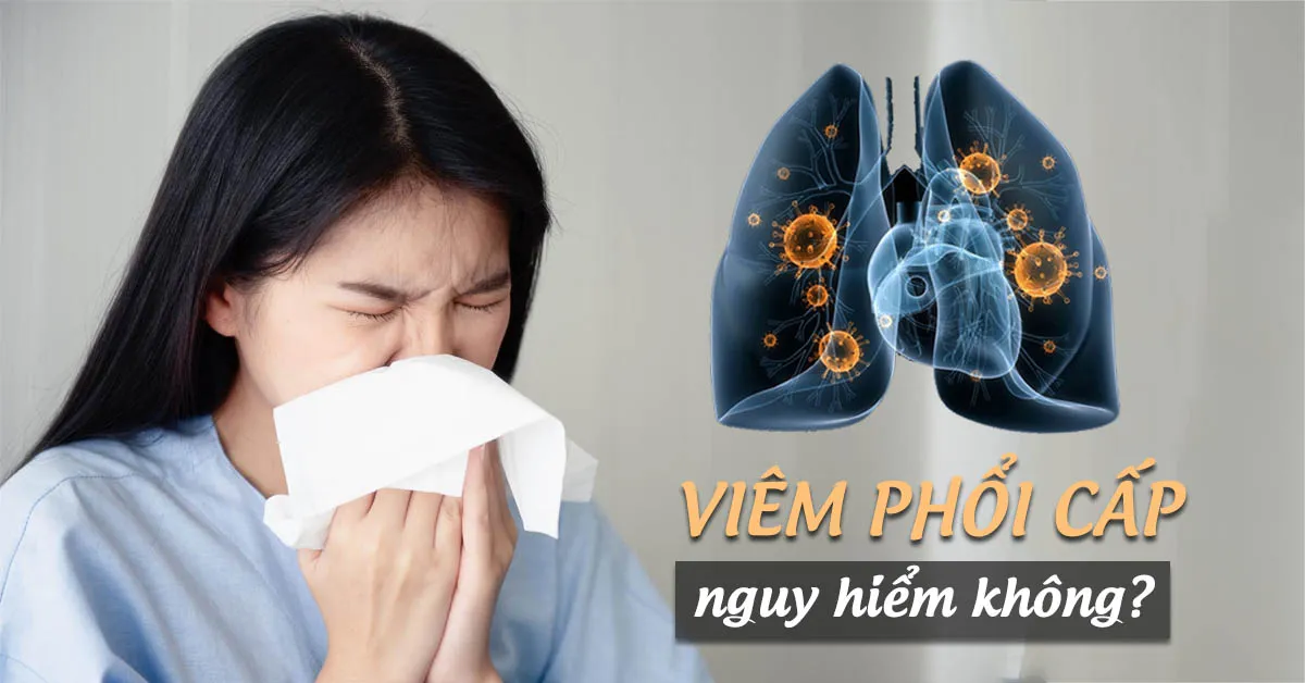 Viêm phổi cấp chớ nên xem thường!