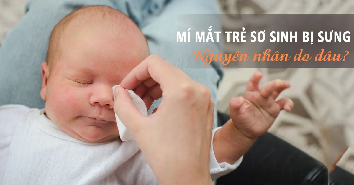 5 nguyên nhân khiến mí mắt trẻ sơ sinh bị sưng đỏ và cách điều trị
