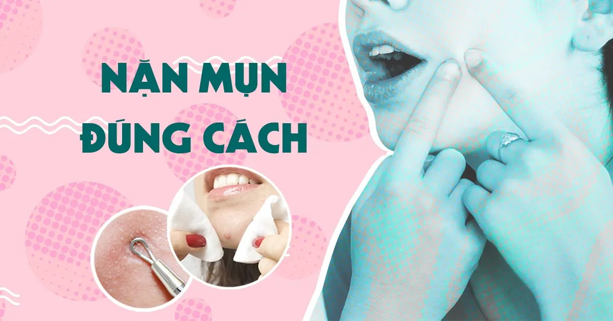 Hướng dẫn nặn mụn đúng cách tại nhà