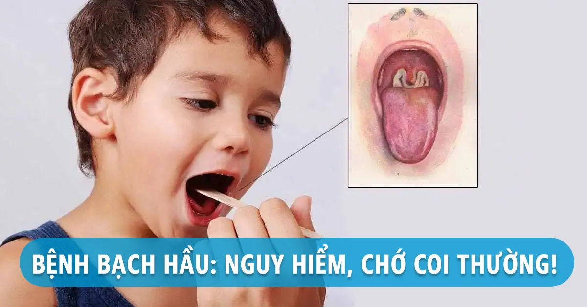 Bệnh bạch hầu nguy hiểm như thế nào, dấu hiệu bệnh có dễ nhận biết?