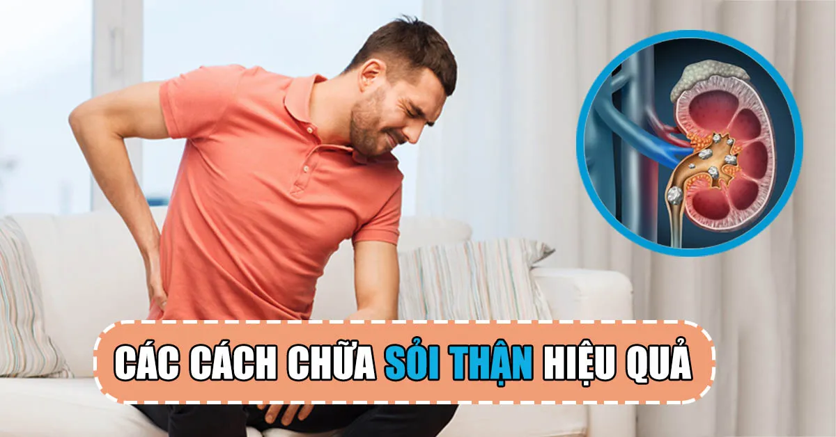 Các cách chữa sỏi thận phù hợp cho từng kích thước sỏi