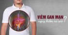 Viêm gan mạn: triệu chứng, nguyên nhân, biến chứng, cách điều trị và phòng ngừa