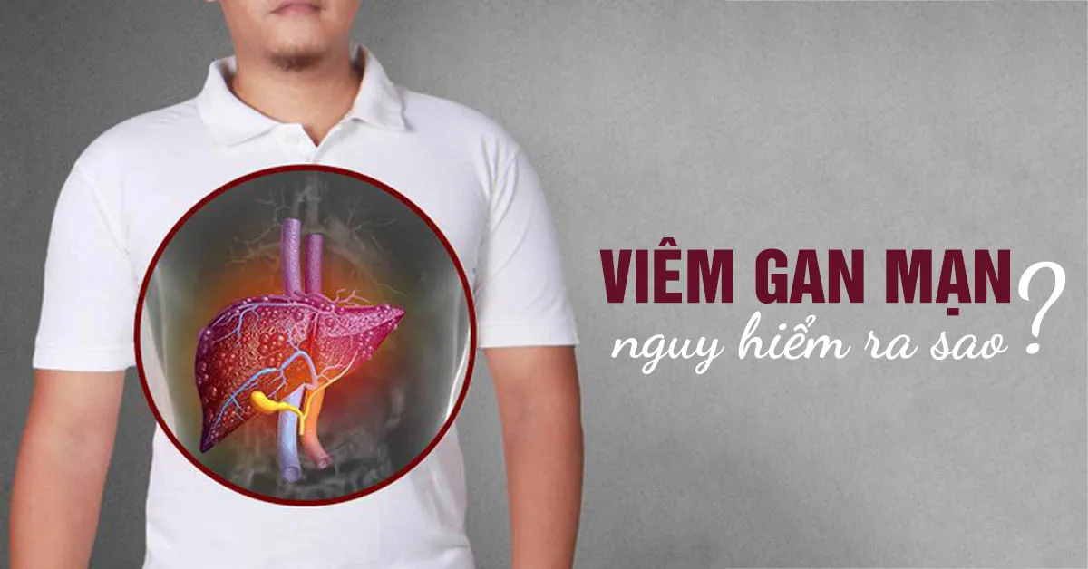 Viêm gan mạn: triệu chứng, nguyên nhân, biến chứng, cách điều trị và phòng ngừa