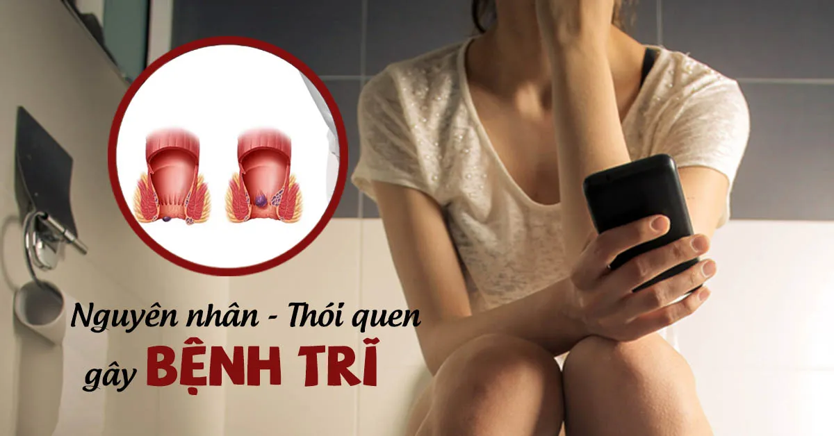 8 nguyên nhân bệnh trĩ và 5 đối tượng có nguy cơ cao