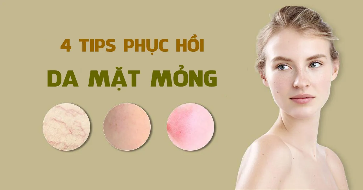 4 cách phục hồi da mặt mỏng và đỏ hiệu quả tại nhà