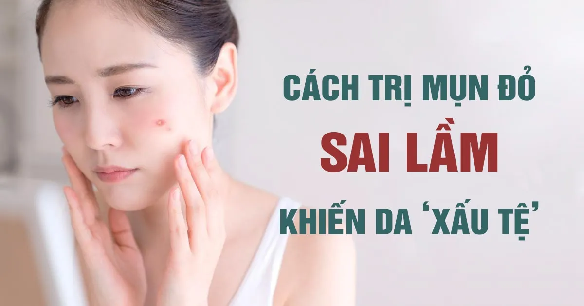 Những cách trị mụn đỏ sai lầm khiến da ‘xuống cấp’ trầm trọng