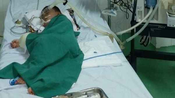 Bé trai 4 tuổi bị ong vò vẽ đốt 80 mũi qua cơn nguy kịch