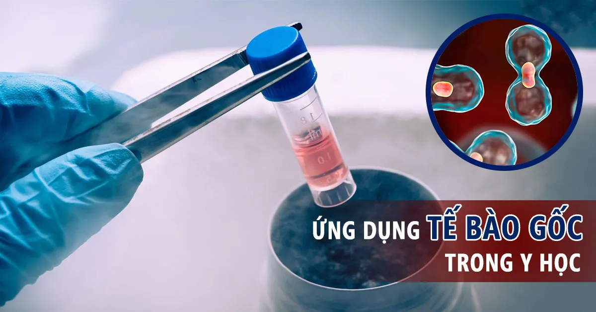 Tế bào gốc là gì? Phân loại, công dụng trong y học 