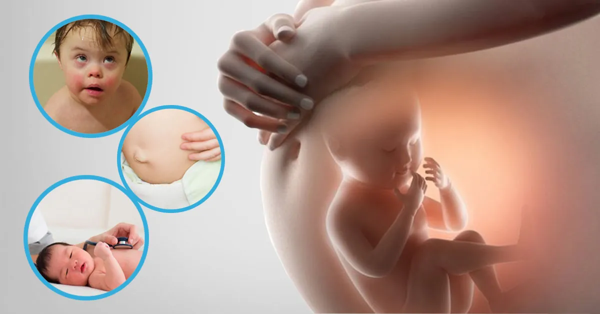 Dị tật bẩm sinh là gì? 6 nguyên nhân không thể xem thường