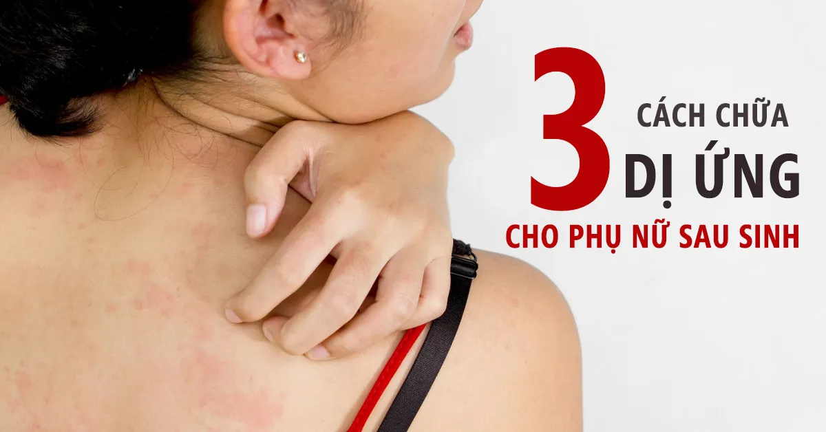 Nguyên nhân gây dị ứng sau sinh và 3 cách chữa đơn giản tại nhà