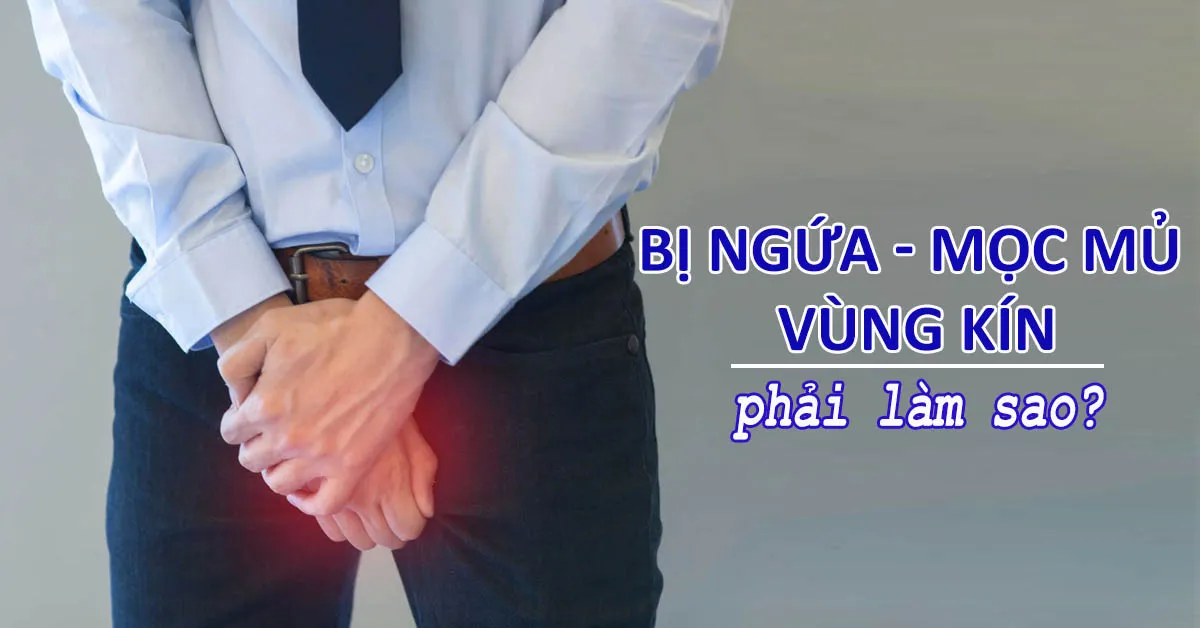 ‘Cả thảy’ nguyên nhân gây ngứa vùng kín nam giới bạn đã biết chưa? 