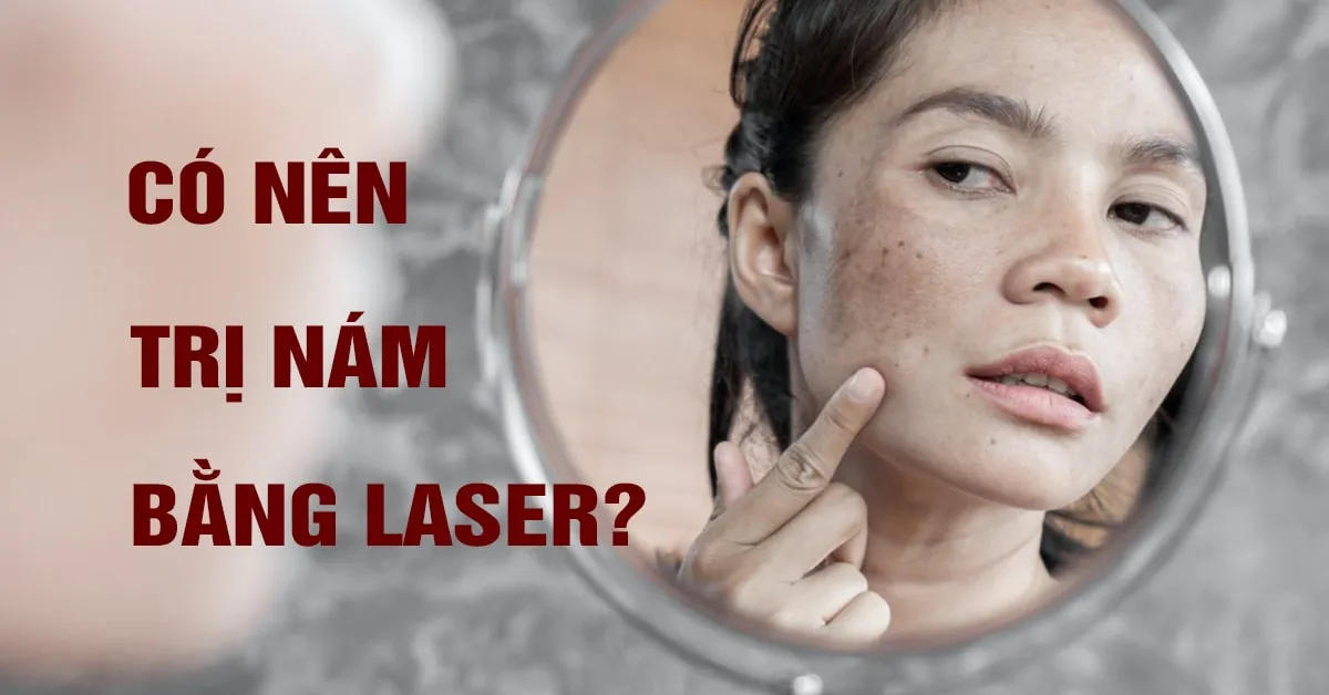 Trị nám bằng laser có tốt không? Làm thế nào để trị nám bằng laser hiệu quả?