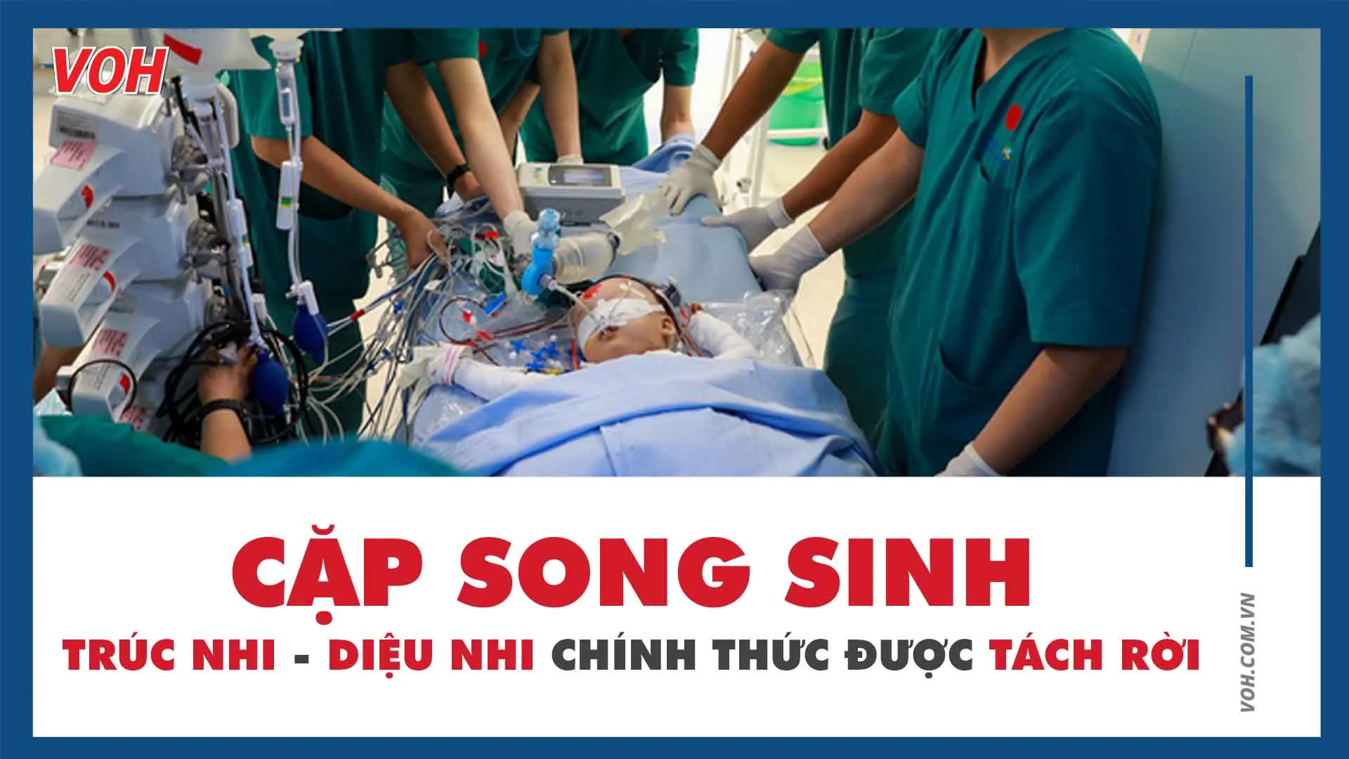 Cặp song sinh Trúc Nhi - Diệu Nhi chính thức được tách rời