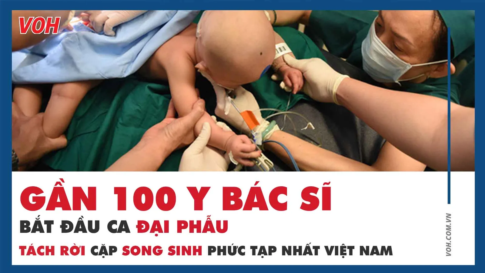 Gần 100 y bác sĩ bắt đầu ca đại phẫu tách rời cặp song sinh phức tạp nhất Việt Nam