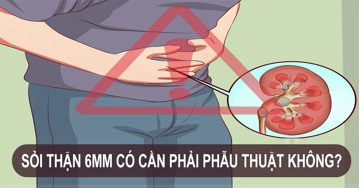 Kích cỡ sỏi thận 6mm có nguy hiểm không? Điều trị bằng phương pháp nào?