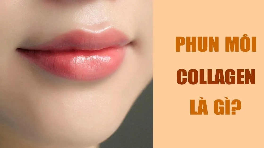 Phun môi collagen là gì? Có nên phun môi collagen không?